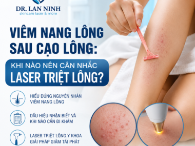Viêm nang lông sau cạo lông: Khi nào nên triệt lông laser?